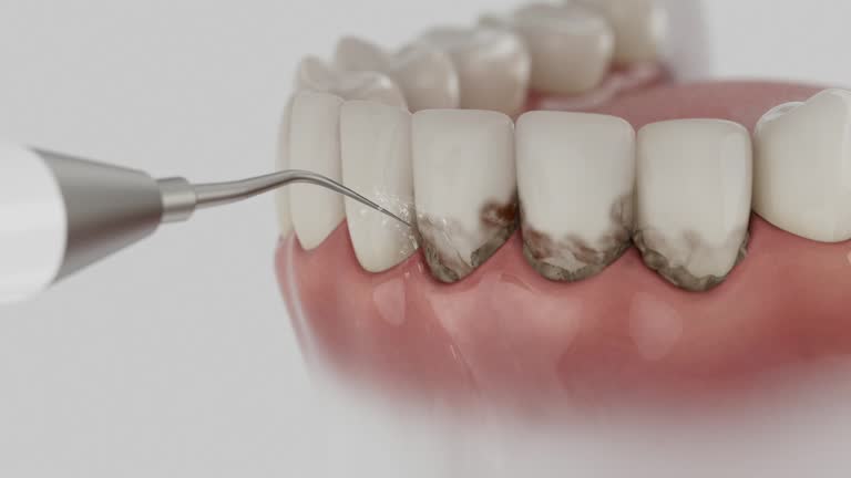 Reliable Dental contractor in Bronson, MI by Dentist Open Now